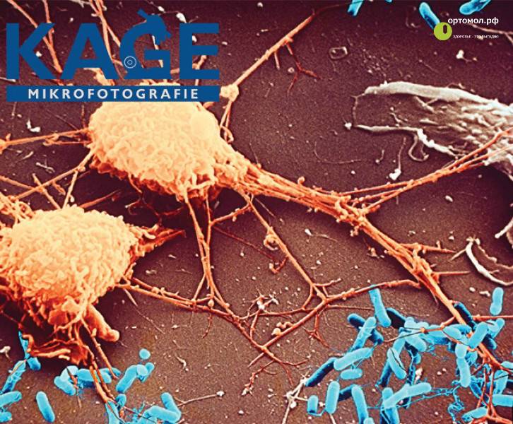 Фагоциты - защитные клетки иммунной системы человека